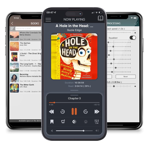 Download fo free audiobook A Hole in the Head: A gruesomely grisly history of medical firsts by Suzie Edge and listen anywhere on your iOS devices in the ListenBook app.