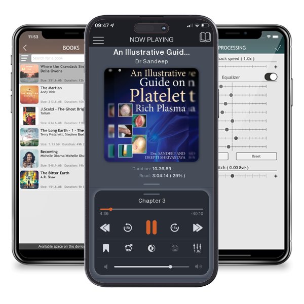 Download fo free audiobook An Illustrative Guide on Platelet Rich Plasma by Dr Sandeep and listen anywhere on your iOS devices in the ListenBook app.