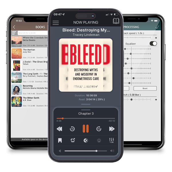 Download fo free audiobook Bleed: Destroying Myths and Misogyny in Endometriosis Care by Tracey Lindeman and listen anywhere on your iOS devices in the ListenBook app.