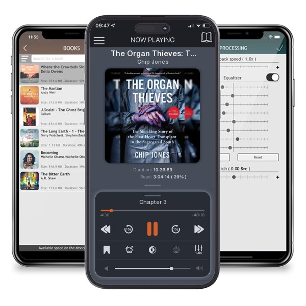 Download fo free audiobook The Organ Thieves: The Shocking Story of the First Heart... by Chip Jones and listen anywhere on your iOS devices in the ListenBook app.